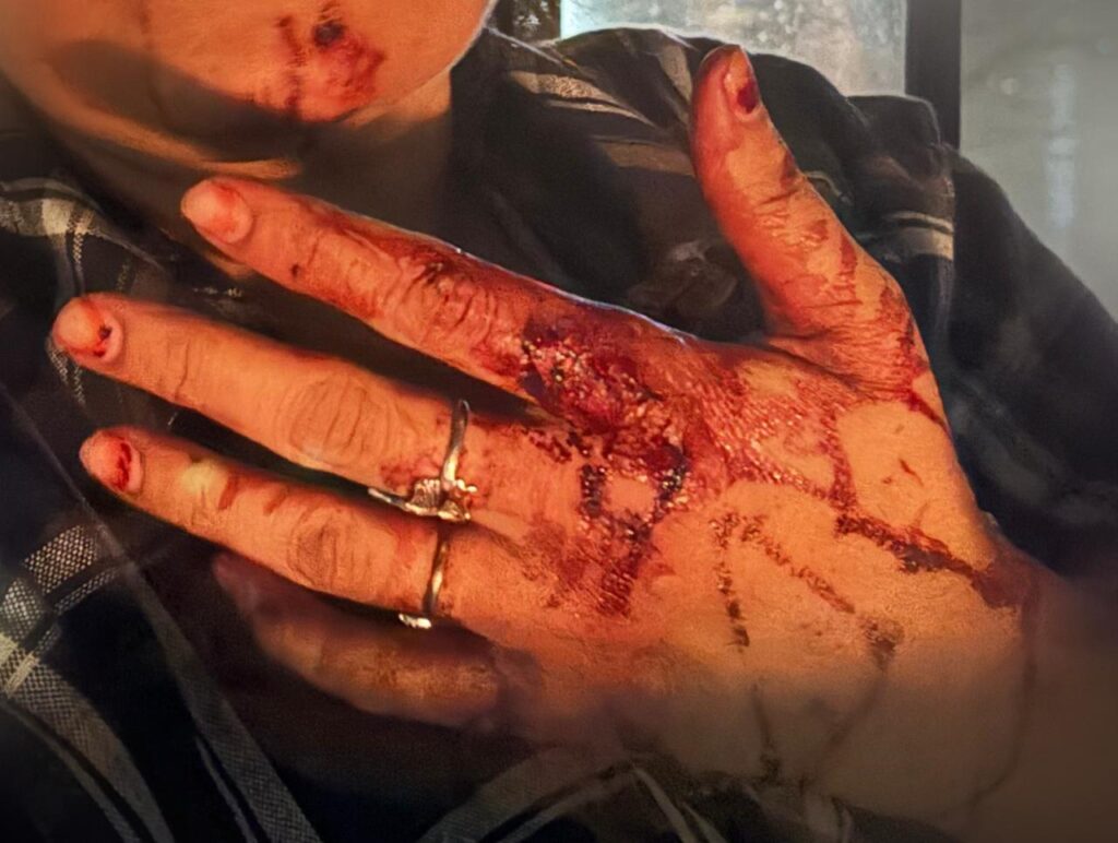 राजधानी में महिला सहित परिवार के साथ मारपीट की शर्मनाक घटना