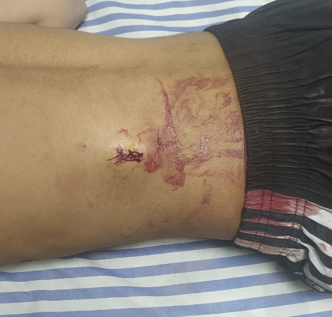 मोवा के अमन नगर में चाकूबाजी