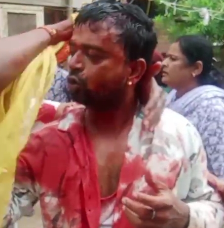 आवारा कुत्ते के विवाद में चाकूबाजी