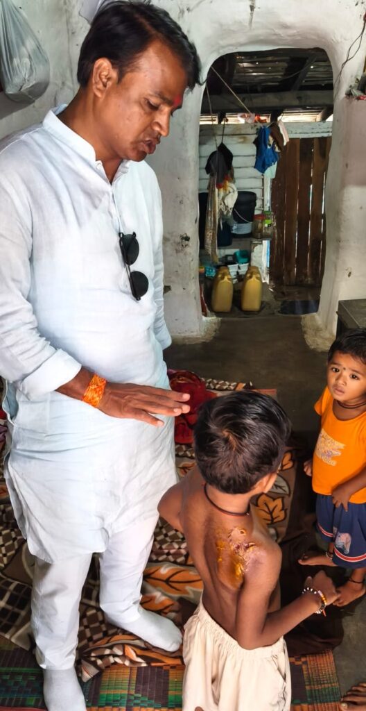 वार्ड 11 में आवारा कुत्तों के हमले से मासूम घायल, पार्षद मोहन साहू ने दिलाया इलाज व कार्रवाई का आश्वासन”