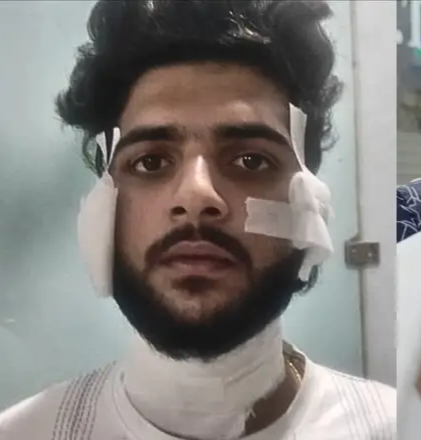 सेंट्रल जेल में चला चाकू