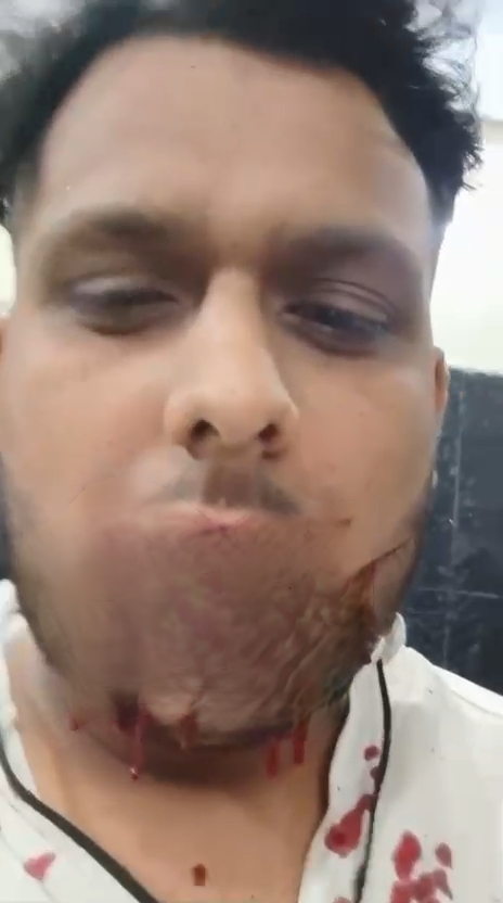 राजधानी में चाइनीज मांझे का खौफ जारी,