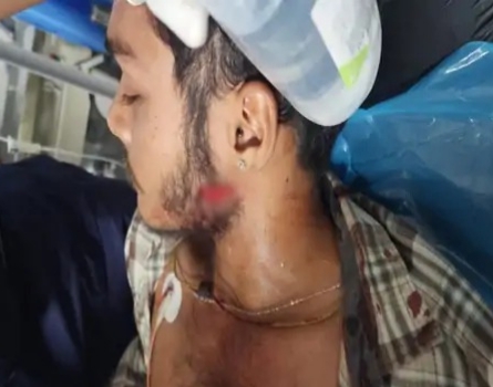 रोड रेज में खूनी वार: बाइक सवार ने युवक पर चाकू से किया जानलेवा हमला, आरोपी हिरासत में