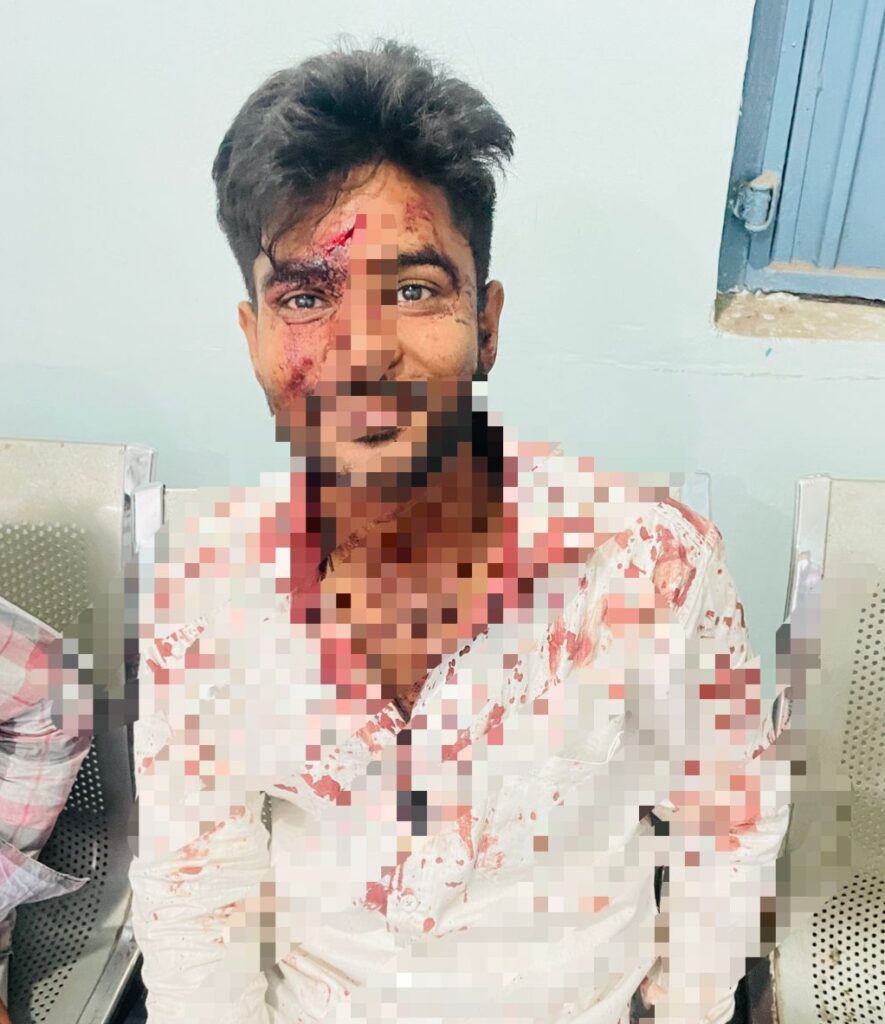 युवक पर चाकू से हमला, पुरानी रंजिश में वारदात